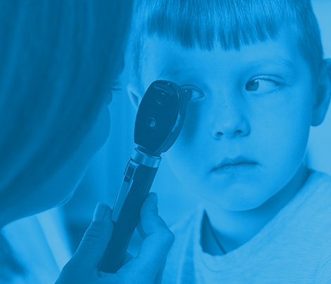 Manejo del estrabismo desde la neurociencia