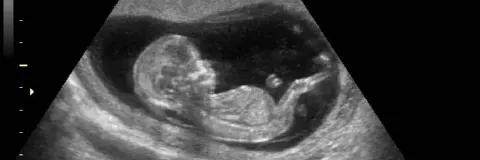 ¿Qué implica la despenalización del aborto en Colombia?