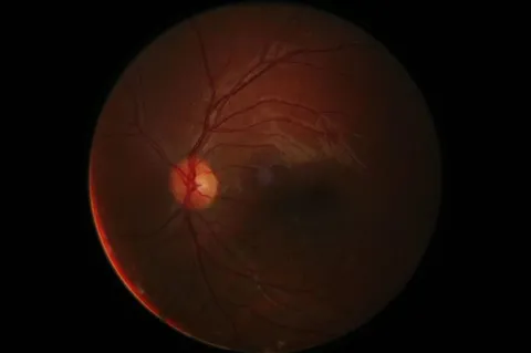 25 de septiembre: día mundial de la retina