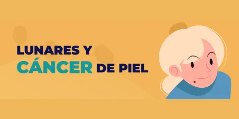 Lunares y cáncer de piel