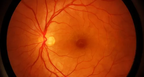 La retina es una estructura ocular que se referencia como extensión del cerebro. 