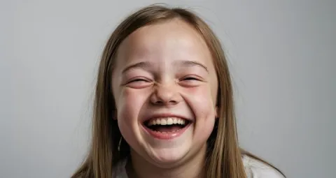 El síndrome de Silver Rusell (SSR) fue descrito por primera vez por Silver y Russell entre 1953 y 1954. 