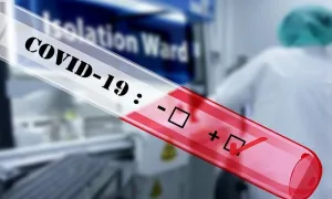 El SARS-CoV-2: un virus relacionado a cambios cerebrales negativos