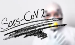 Cuando sí y no una prueba rápida del SARS Cov 2