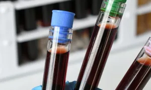 Puntos claves para entender la zoonosis
