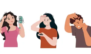 Alopecia, lo que deberías saber de la caída del cabello