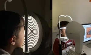 Atención Clínica de Optometría