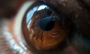 Usar o no usar lentes de contacto en medio de la pandemia