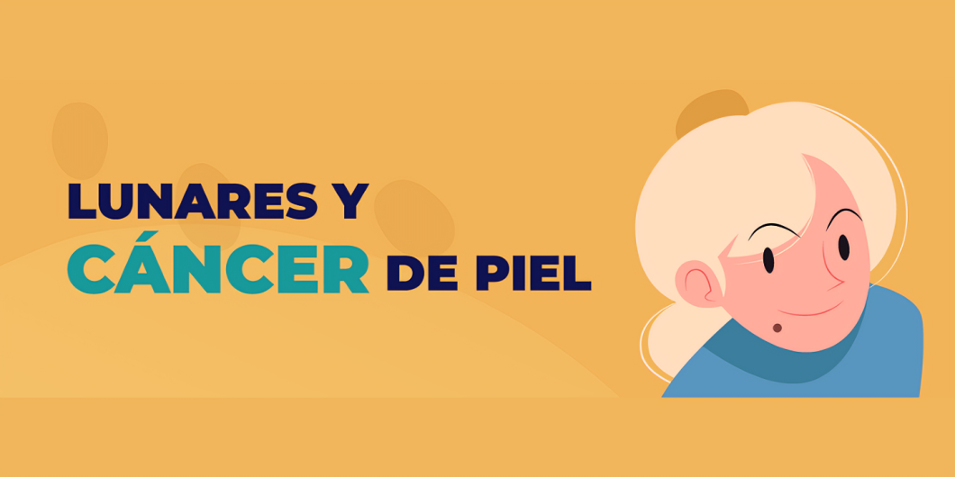 Lunares y cáncer de piel