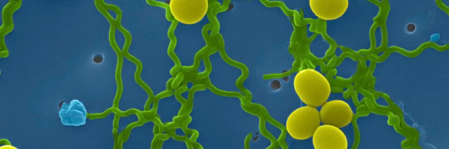 Una Salud: enfoque integral en prevención y control de la leptospirosis