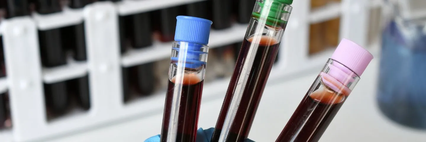 Puntos claves para entender la zoonosis