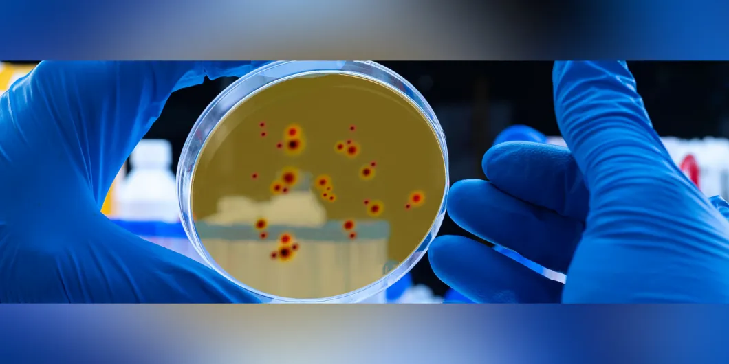 Esto es lo que debes saber sobre la viruela del mono