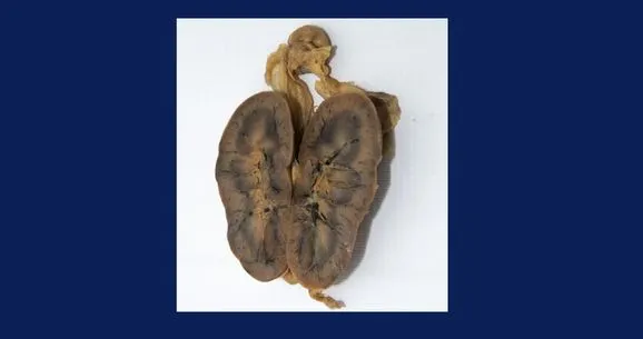 ANATOMY