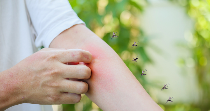 Picadura de mosquito