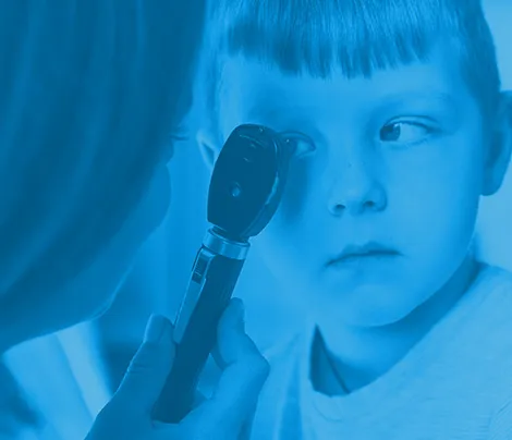 Manejo del estrabismo desde la neurociencia